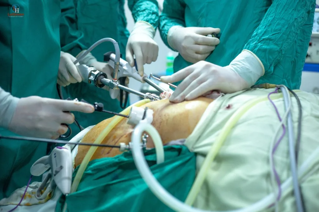Bariatric Surgery at LuQman International Hospital, view 1