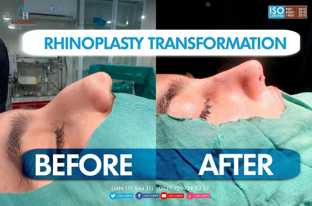 Plastic Surgery department at LuQman International Hospital
